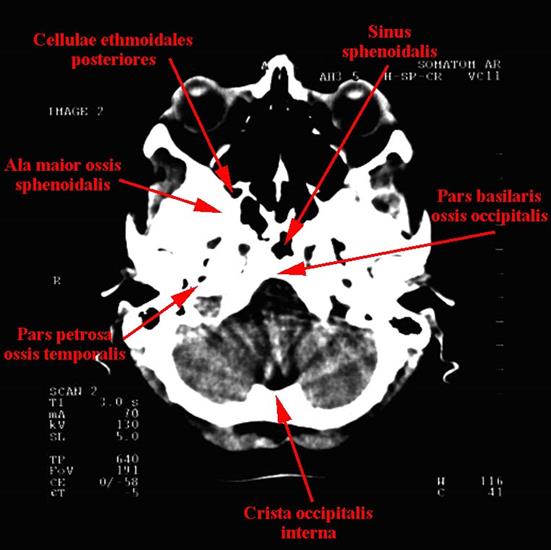 anatomia radiologiczna - 01a.jpg